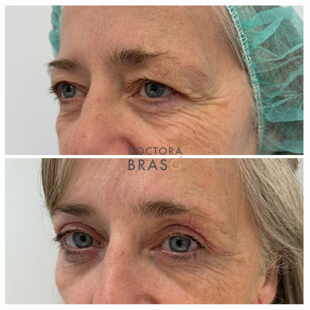 Clinic Results Gallery